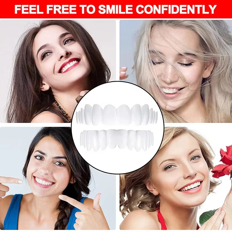 Teeth Whitening veneers (Perfect Smile)