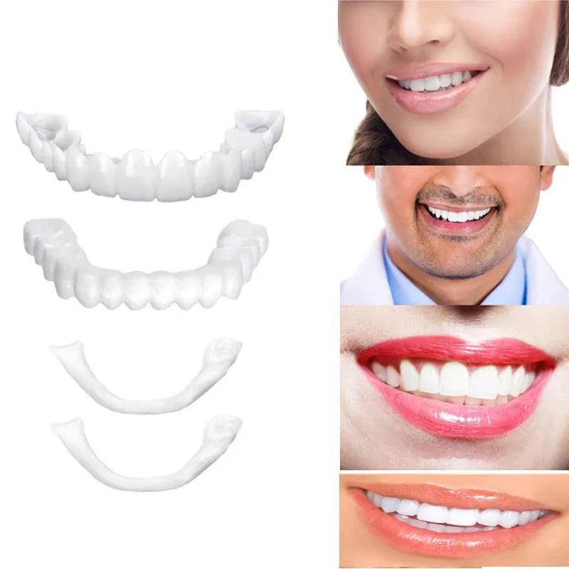 Teeth Whitening veneers (Perfect Smile)